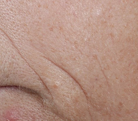Skin Beuticals