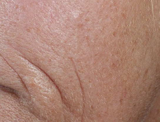 Skin Beuticals