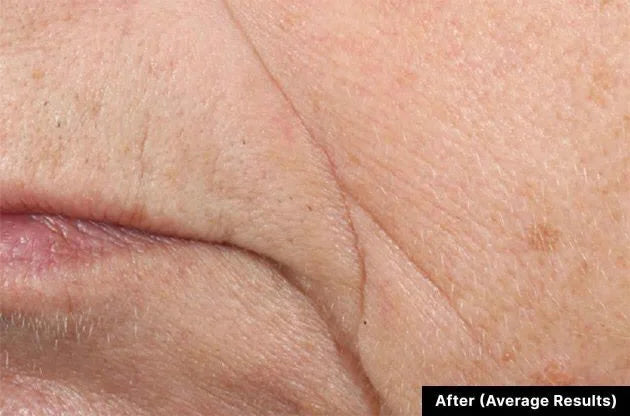 After treatment
