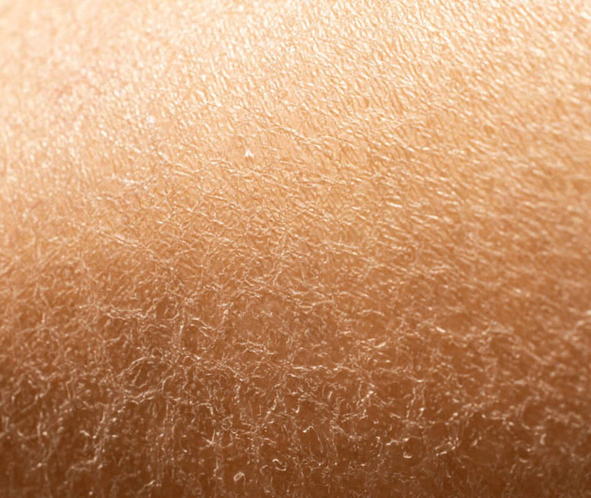What is Dehydrated Skin?